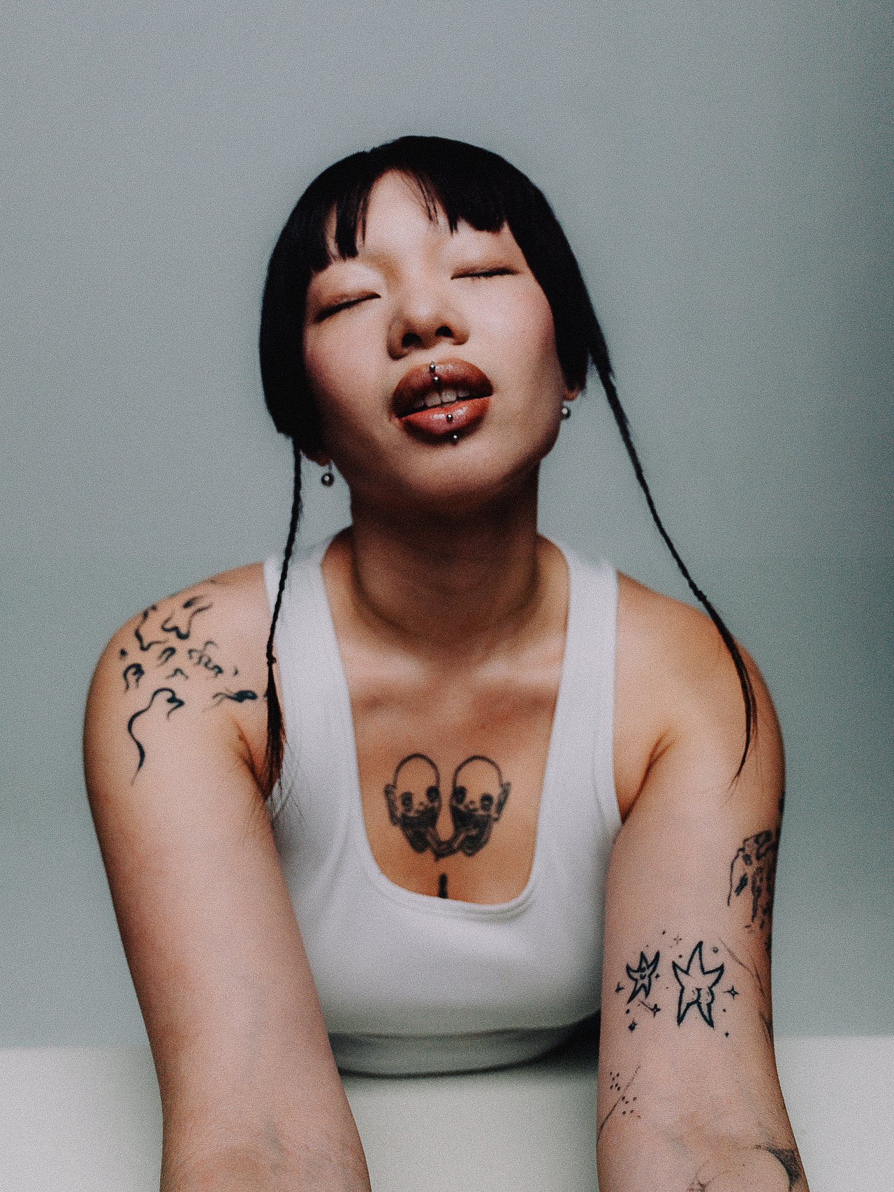 EM-A filtered image 11