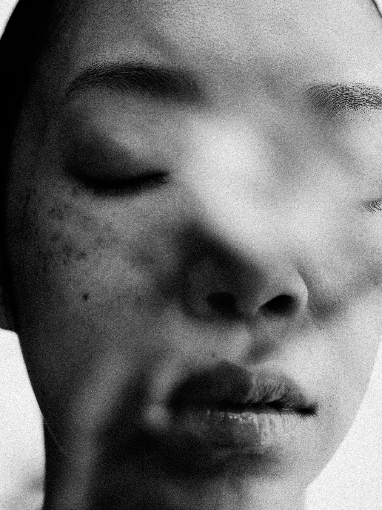 EM-B filtered image 8