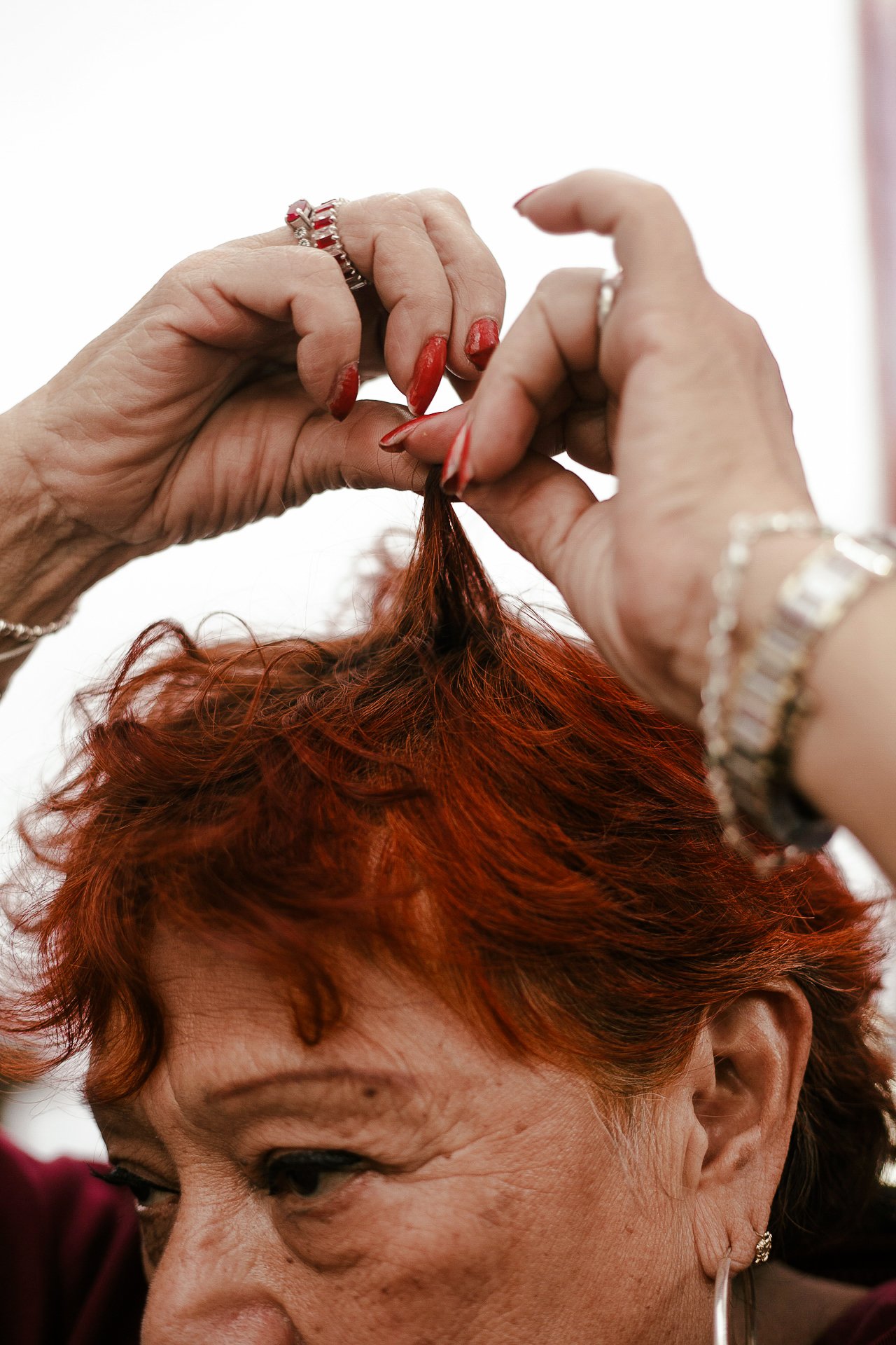 EM-I filtered image 1