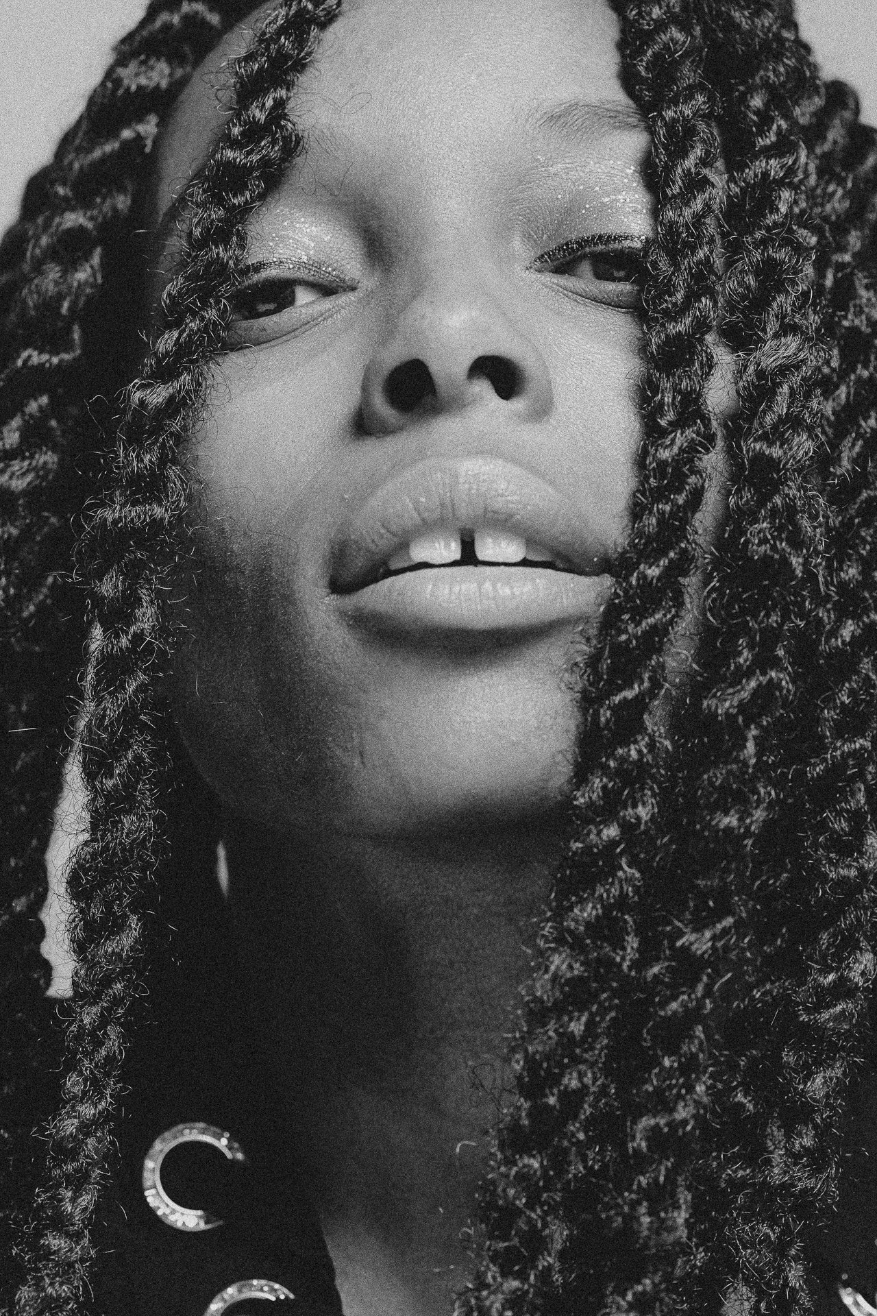 EM-L filtered image 14