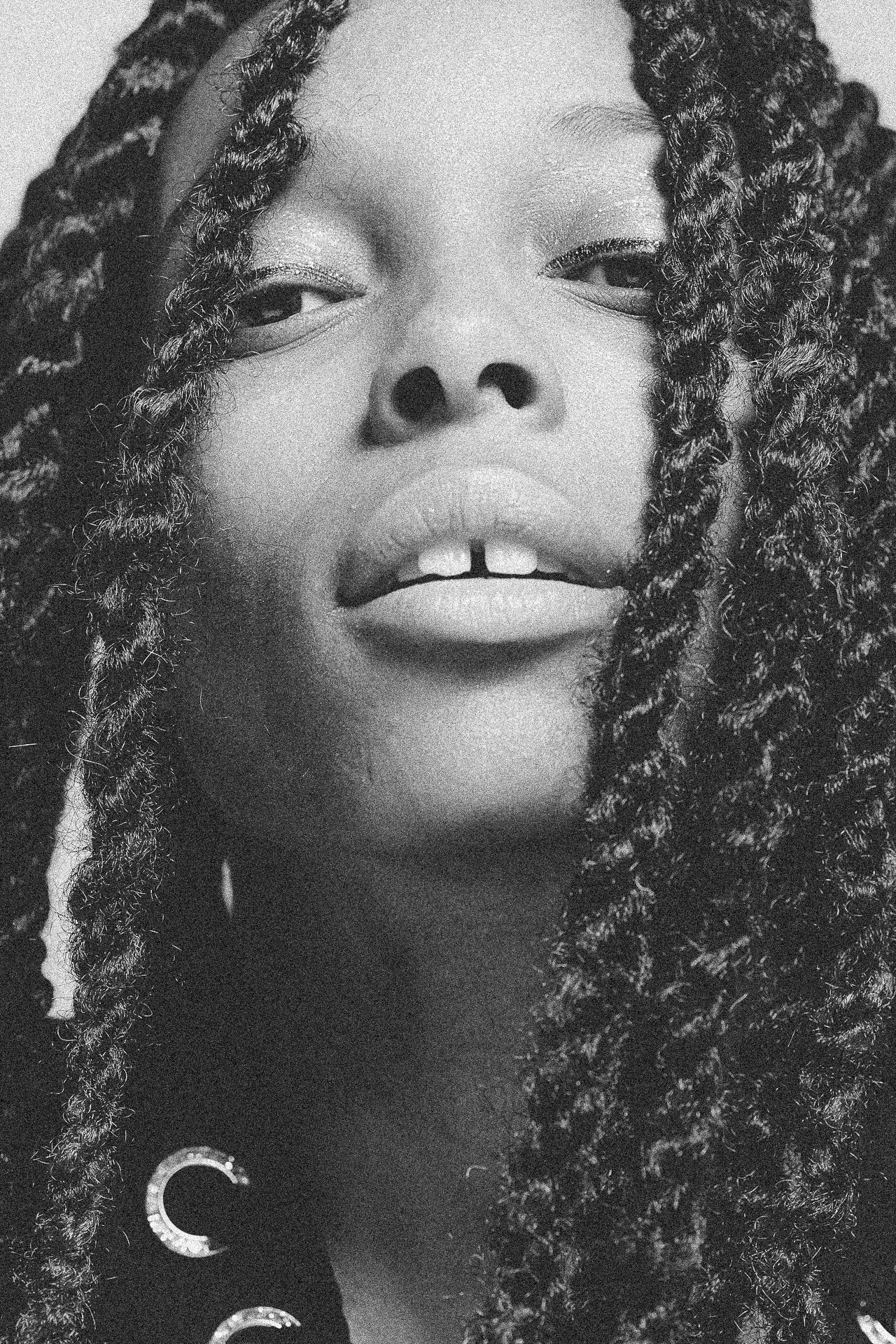 EM-L filtered image 21