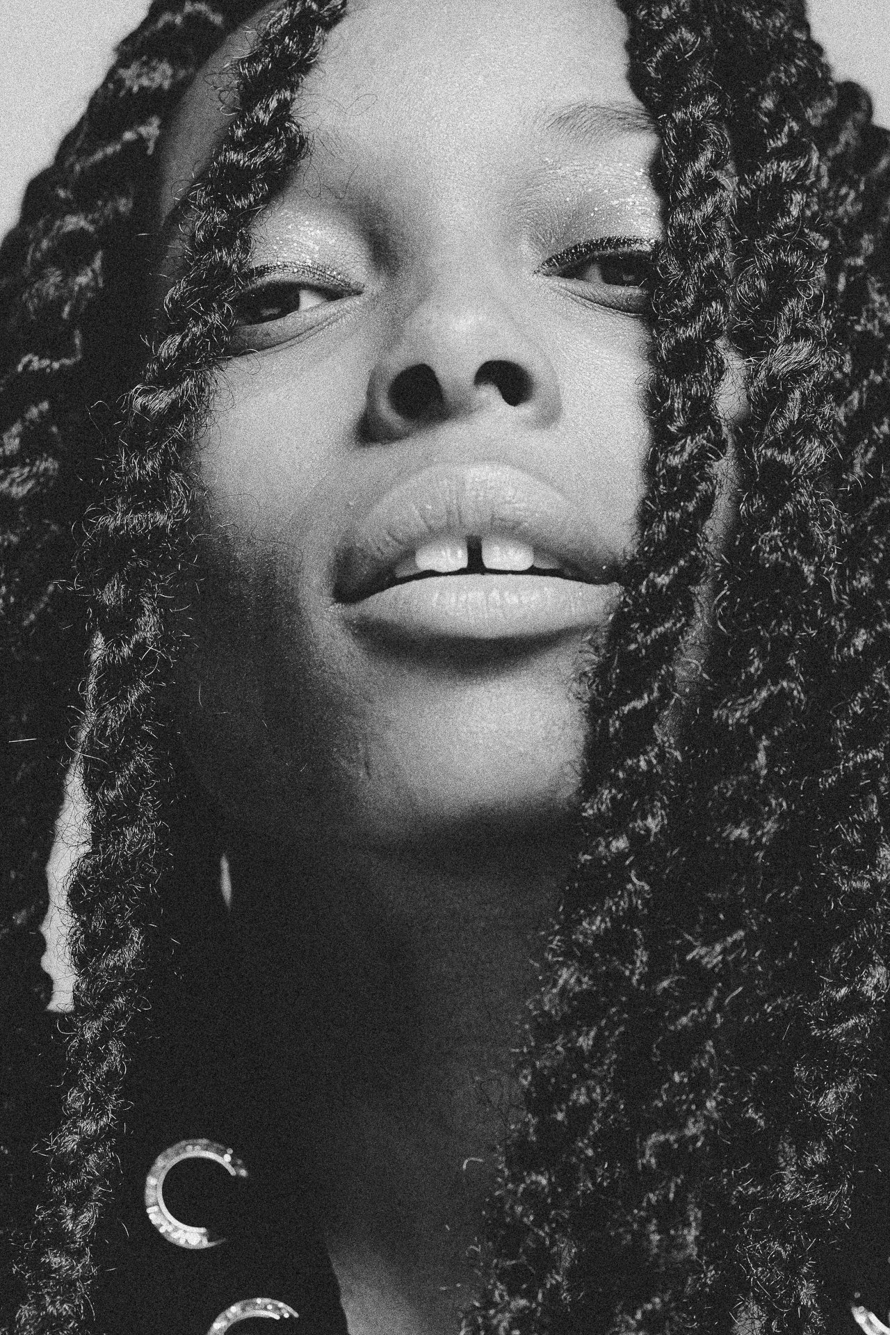 EM-L filtered image 2