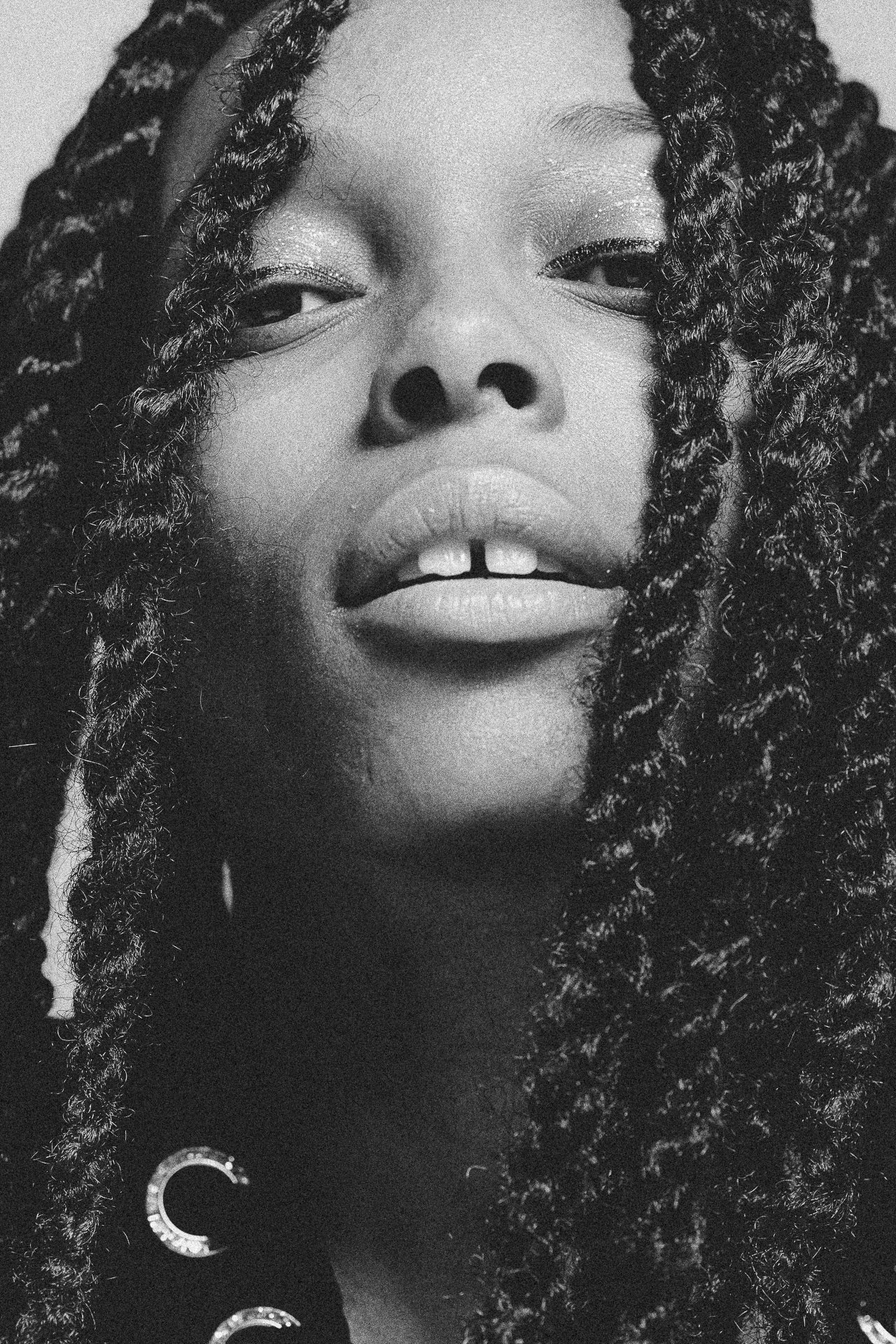 EM-L filtered image 6