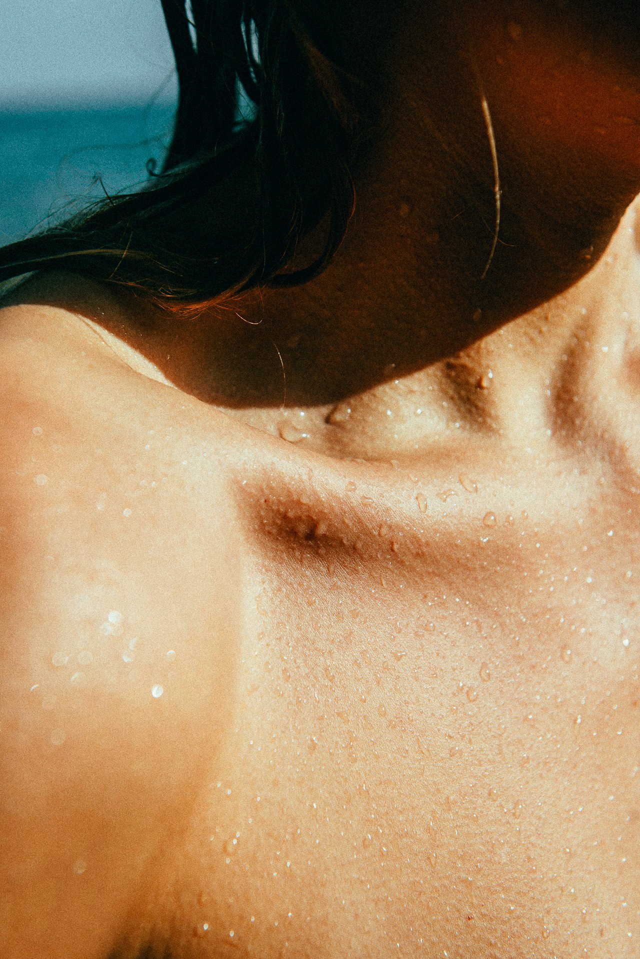 EM-U filtered image 10