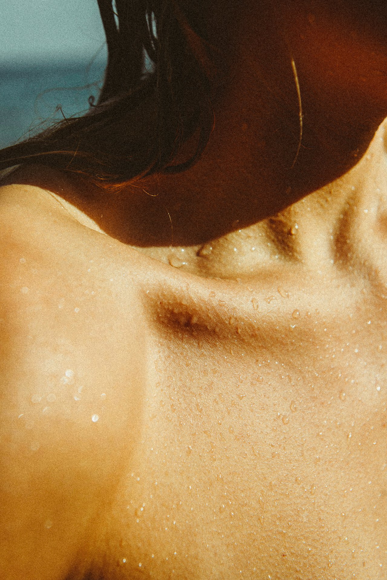 EM-U filtered image 15