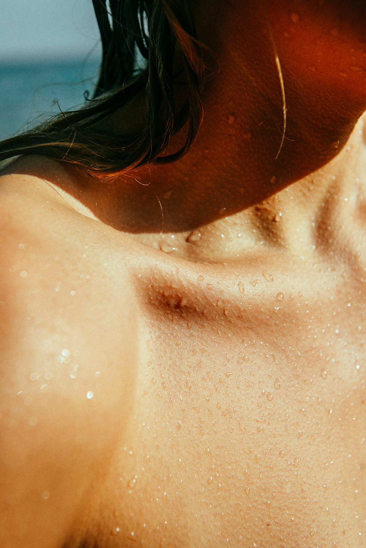 EM-U filtered image 1