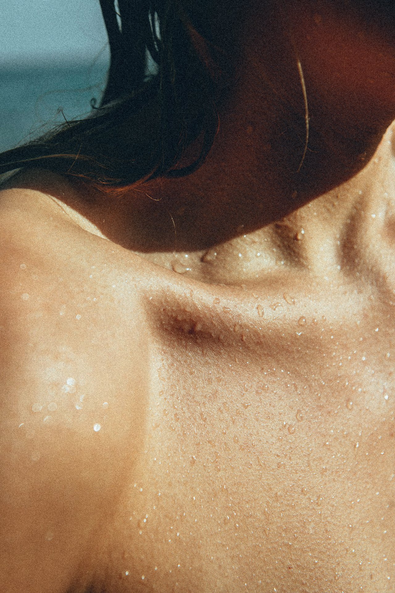 EM-U filtered image 20