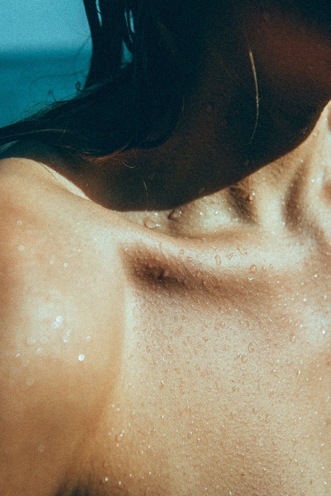 EM-U filtered image 25