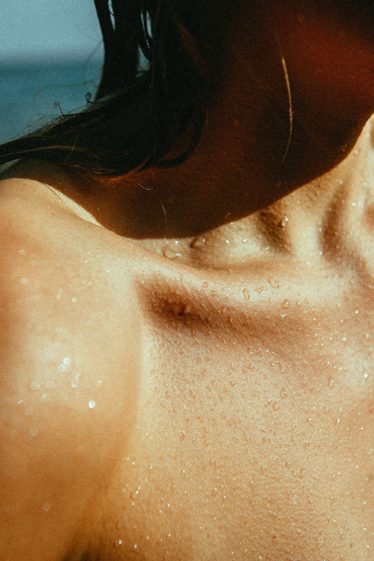 EM-U filtered image 34