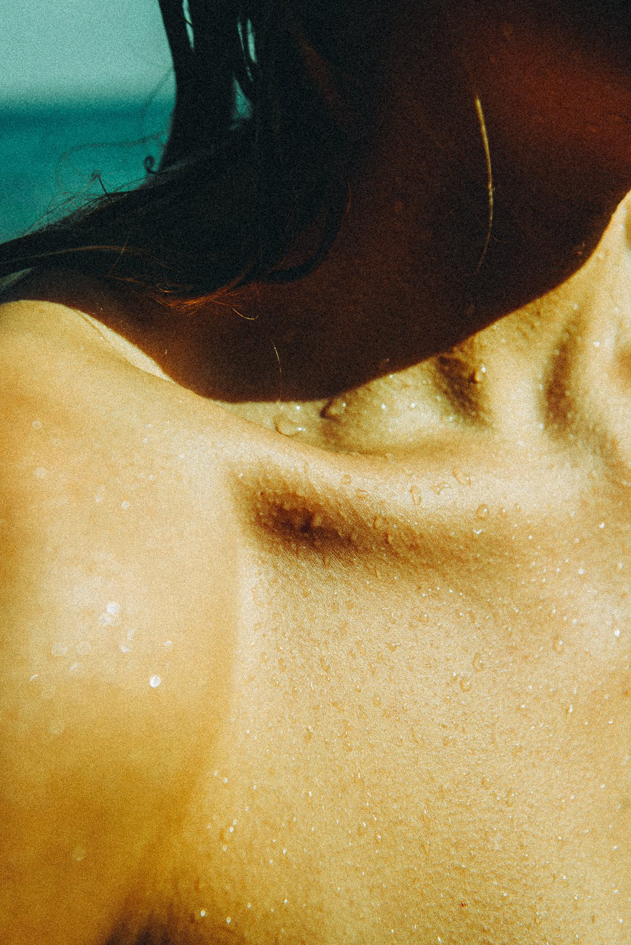 EM-U filtered image 5